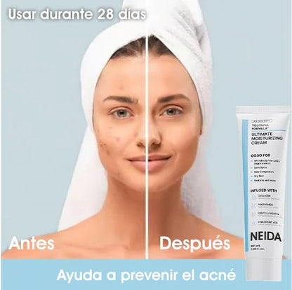 🎉Gran Oferta: 49% de Descuento🎉 Crema Hidratante Suprema NEIDA Youthful Formula