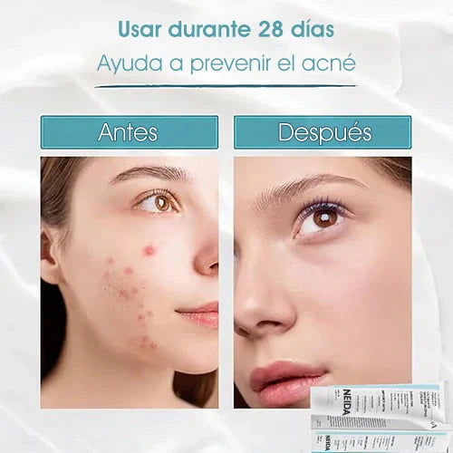 🎉Gran Oferta: 49% de Descuento🎉 Crema Hidratante Suprema NEIDA Youthful Formula