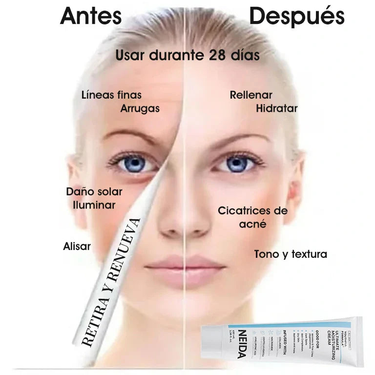 🎉Gran Oferta: 49% de Descuento🎉 Crema Hidratante Suprema NEIDA Youthful Formula