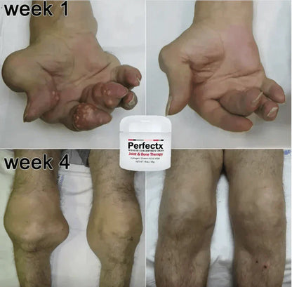 Perfectx™ Terapia Articular Y Muscular