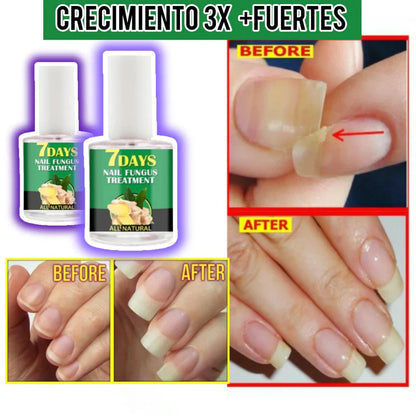 Base Uñas 4 VECES Grandes