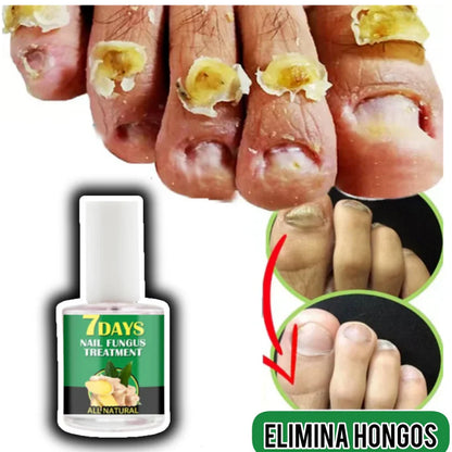 Base Uñas 4 VECES Grandes