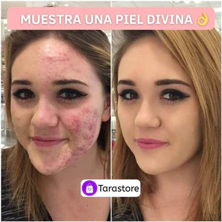 BB CREAM™- Base de alta cobertura