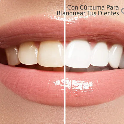 Lumina Smile: Blanqueador Dental Avanzado